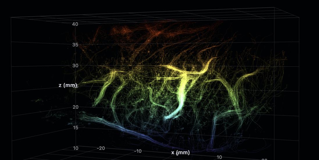 Depth-colored microbubble flow through a living human brain, decoded from transcranial ultrasound